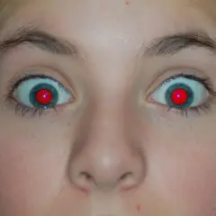 Oczy dziecka z efektem czerwonych źrenic, jak po nieudanym usuwaniu czerwonych oczu.